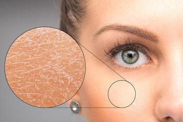 Pourquoi ta peau ne s’hydrate pas malgré ta crème ?