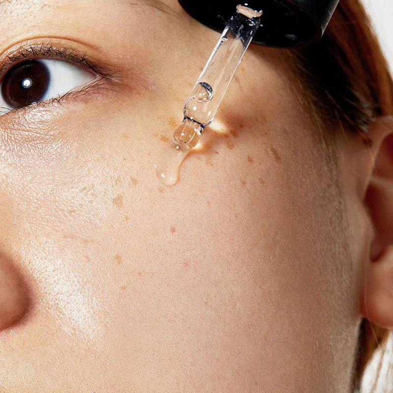 The Niacinamide 15 Serum 20ML - MisoDerma